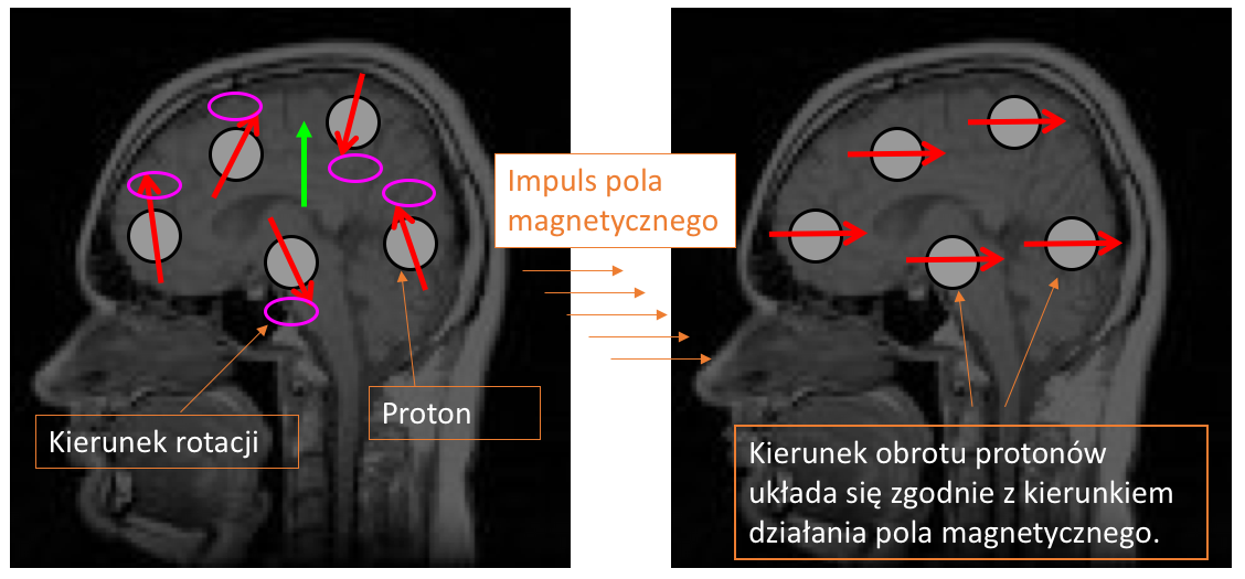 Reakcje protonów na działanie pola magnetycznego. / Źródło: Ilona Kotlewska-Waś, na podstawie: http://www.fmri4newbies.com/lectures 1B: MRI Physics.